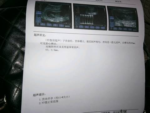 journal_insert_pic_808063777