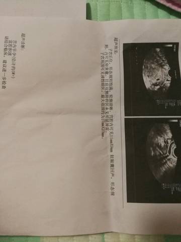 journal_insert_pic_810039394