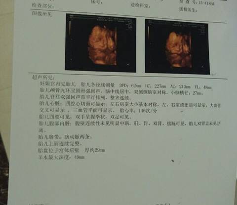 journal_insert_pic_810426932