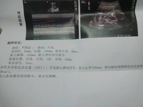 journal_insert_pic_812110491