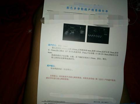 journal_insert_pic_813447136