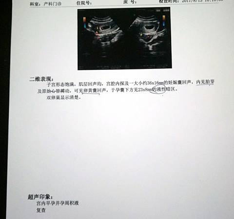 journal_insert_pic_814078328