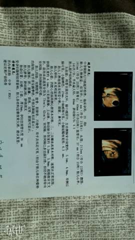 journal_insert_pic_814151058