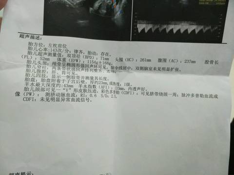 journal_insert_pic_817191933