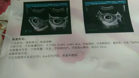 journal_insert_pic_817852423
