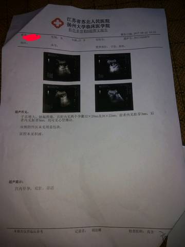 journal_insert_pic_822369829
