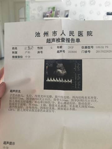 journal_insert_pic_823614920