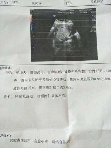 journal_insert_pic_823389017