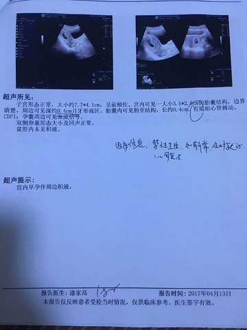 journal_insert_pic_825513344
