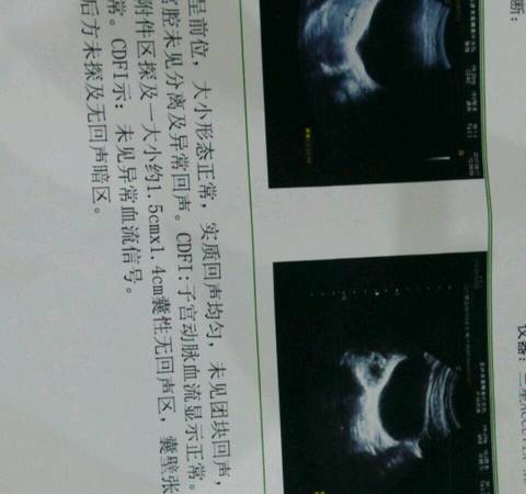 journal_insert_pic_827305339