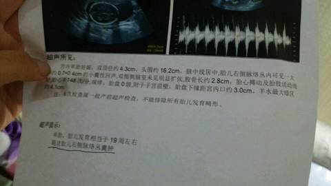 journal_insert_pic_832181528