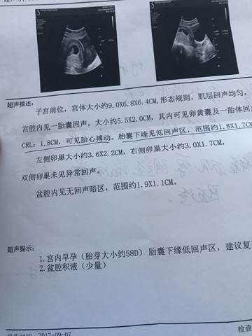 journal_insert_pic_833912451