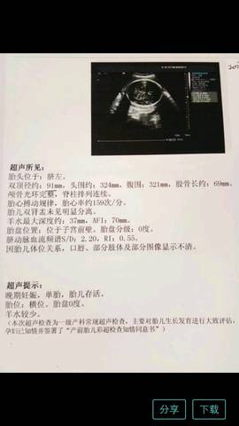 journal_insert_pic_833562260