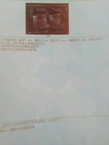 journal_insert_pic_834304373