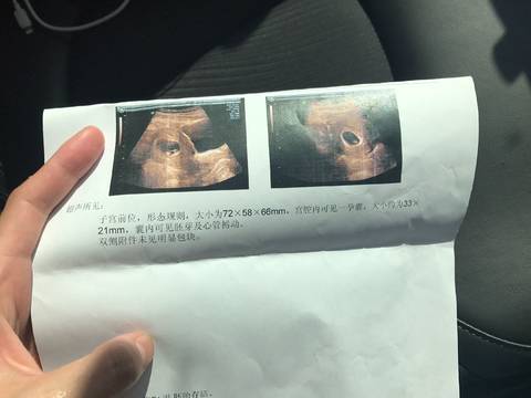 journal_insert_pic_835801030