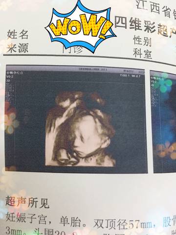 journal_insert_pic_836274896