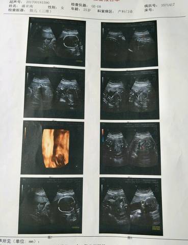 journal_insert_pic_837092319