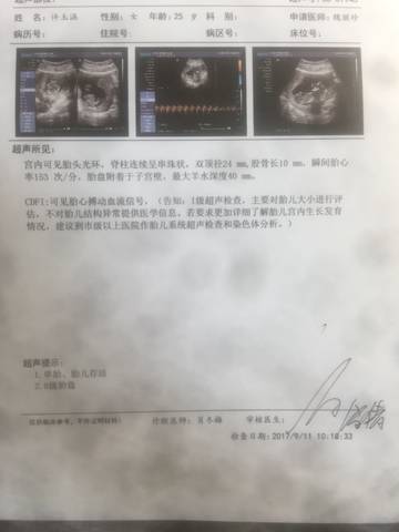 这比超图看得出性别吗?