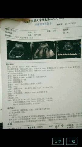 journal_insert_pic_838371623