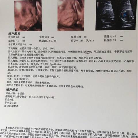 journal_insert_pic_837881134