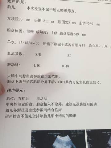journal_insert_pic_838661519