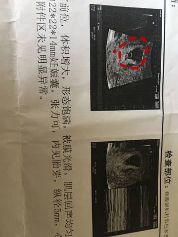 journal_insert_pic_839510793