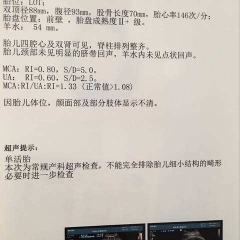 journal_insert_pic_840129866