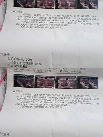 journal_insert_pic_841243593