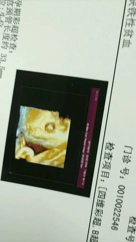 journal_insert_pic_840563942