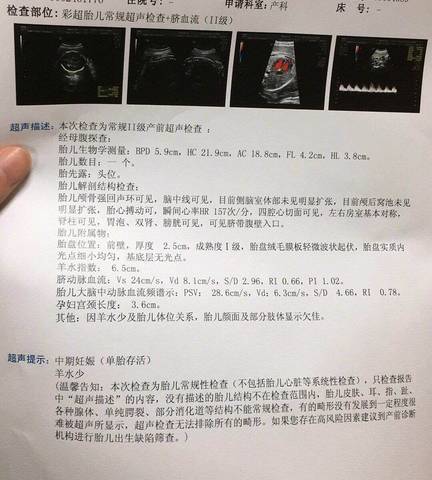 journal_insert_pic_842535987