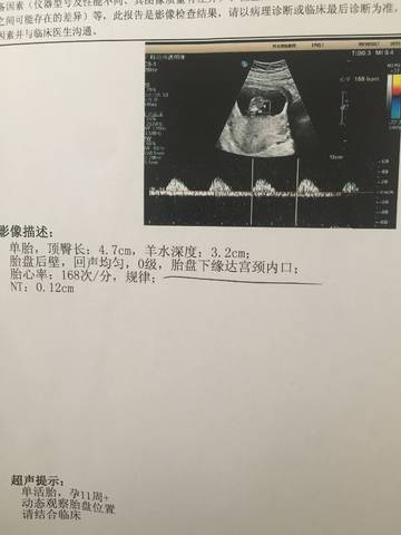 journal_insert_pic_842283960