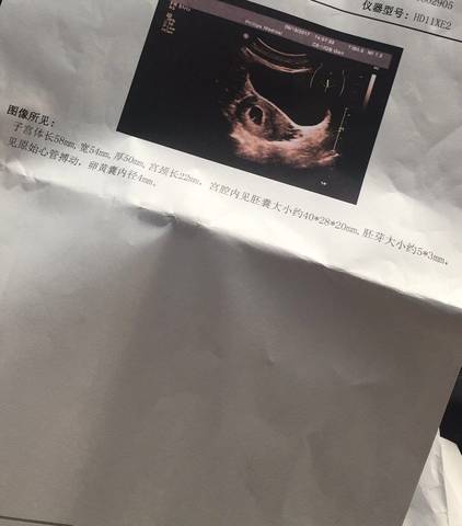 journal_insert_pic_844124960