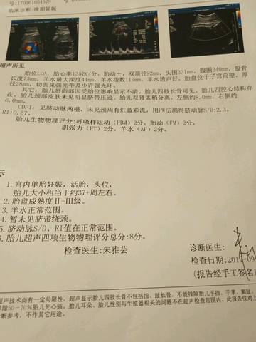 journal_insert_pic_844317080