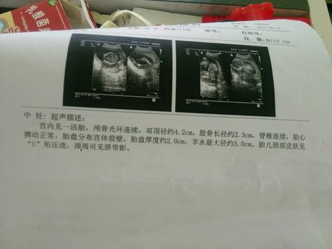 journal_insert_pic_845482116