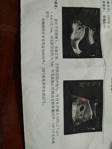 journal_insert_pic_849109558