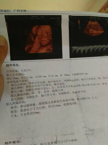 journal_insert_pic_849121329