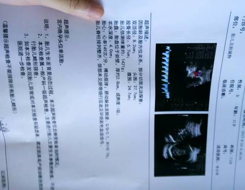 journal_insert_pic_849607981