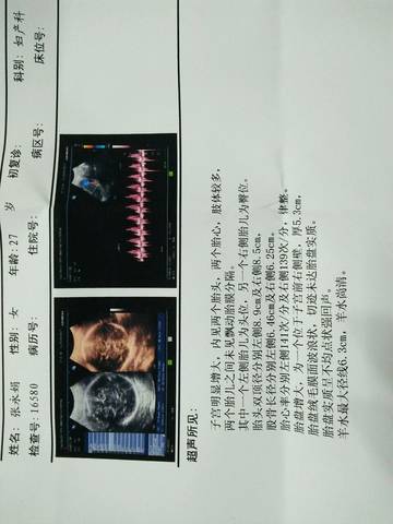 journal_insert_pic_852913035