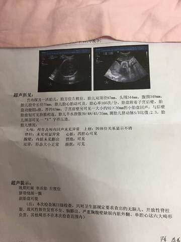 journal_insert_pic_853890175