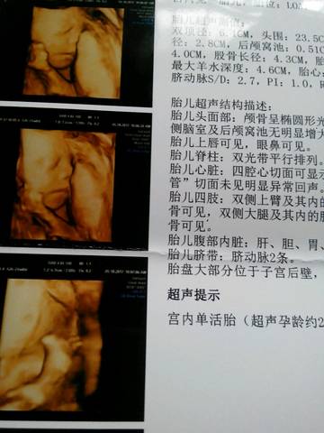 journal_insert_pic_854097091