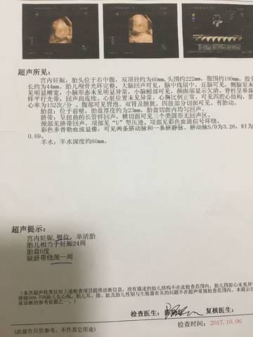 journal_insert_pic_855392041