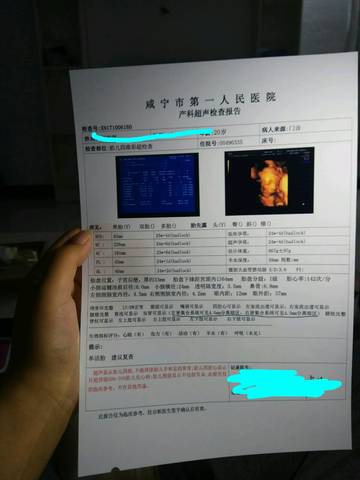 journal_insert_pic_855131859