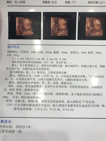 journal_insert_pic_855836088