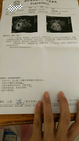 journal_insert_pic_855553504