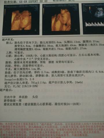 journal_insert_pic_863180468