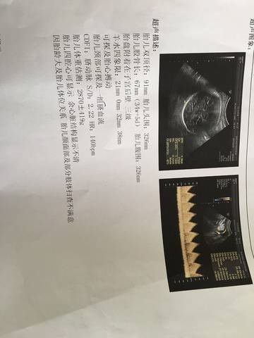 journal_insert_pic_865959333