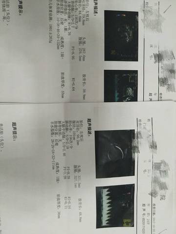 journal_insert_pic_866285089