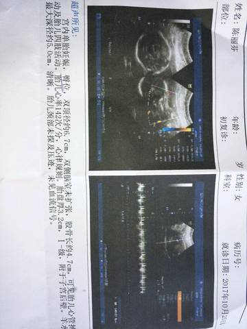 journal_insert_pic_869975418