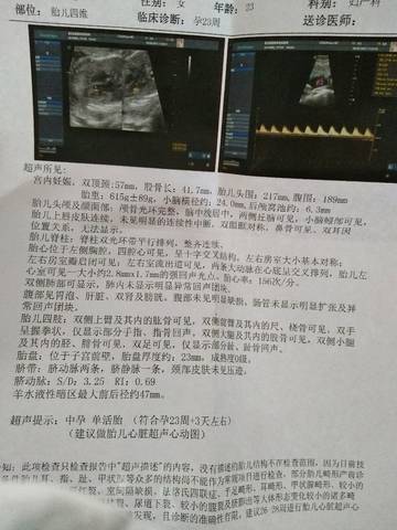 journal_insert_pic_870399705