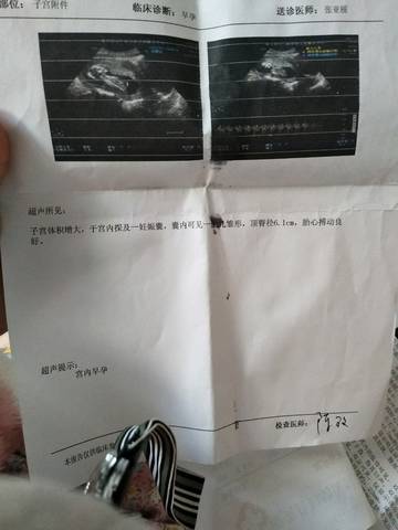 journal_insert_pic_870399685